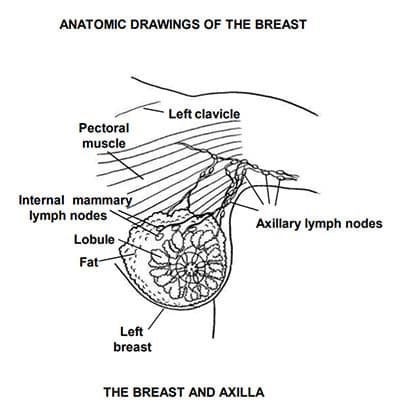 Anatomy of the breast and axilla, showing the pectoral muscle, breast lobules and fatty tissue, and the axillary lymph nodes.