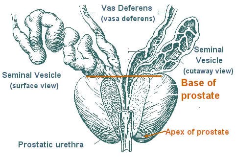 Anatomy of the prostate gland and surrounding structures, including the seminal vesicles and prostatic urethra.